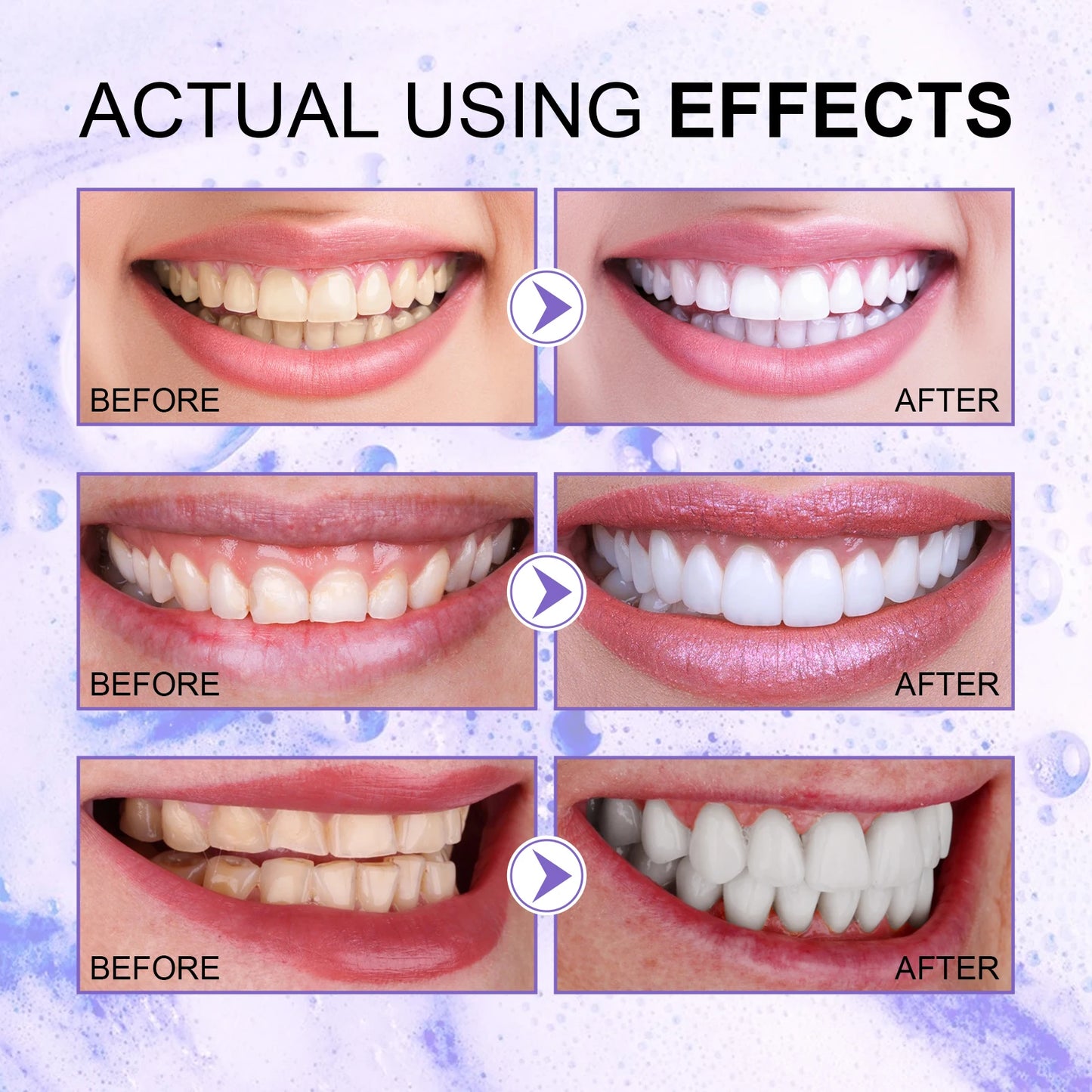 Jaysuing Gums Care Mint Teeth Whitening Mousse Yellow Cleaning Tooth Stains Desalinating Oral Odor Remove Purple Toothpaste 60ml