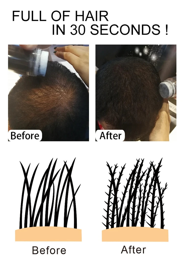Sevich Hair fiber Spray 25g Keratin Hair Building Fibers Regrowth Powder Hair Root Cover Up Thickening Hair Loss Concealer Spray