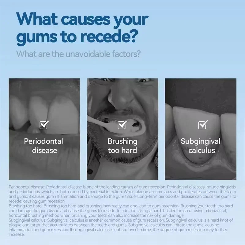 Damaged Gum Repair Care Gel Relieve Sore Gums Allergy Deep Cleaning Teeth Stains Tartar Serum Dental Caries Toothpaste