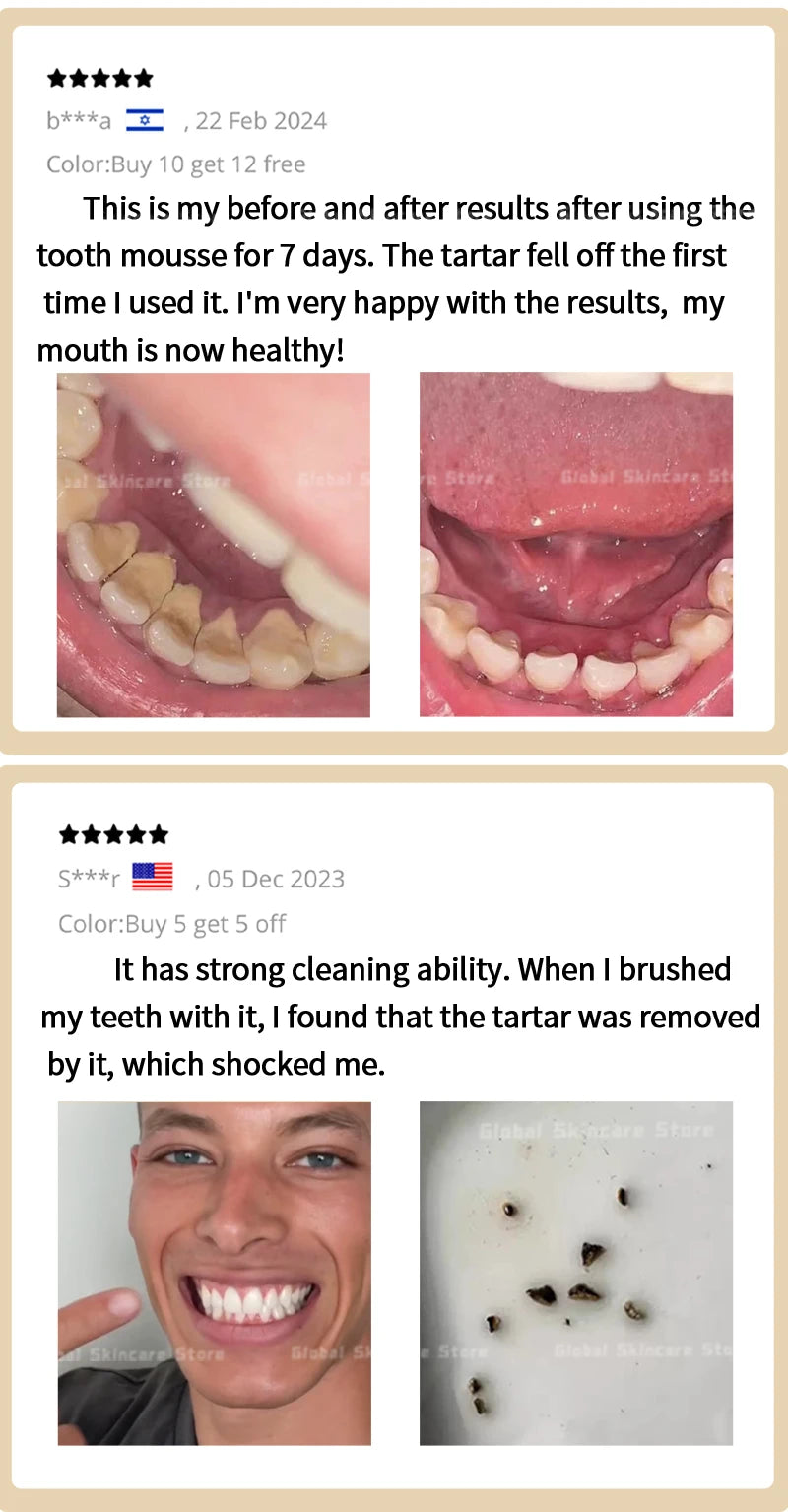 Tartar removers dissolves tartar and eliminates stains