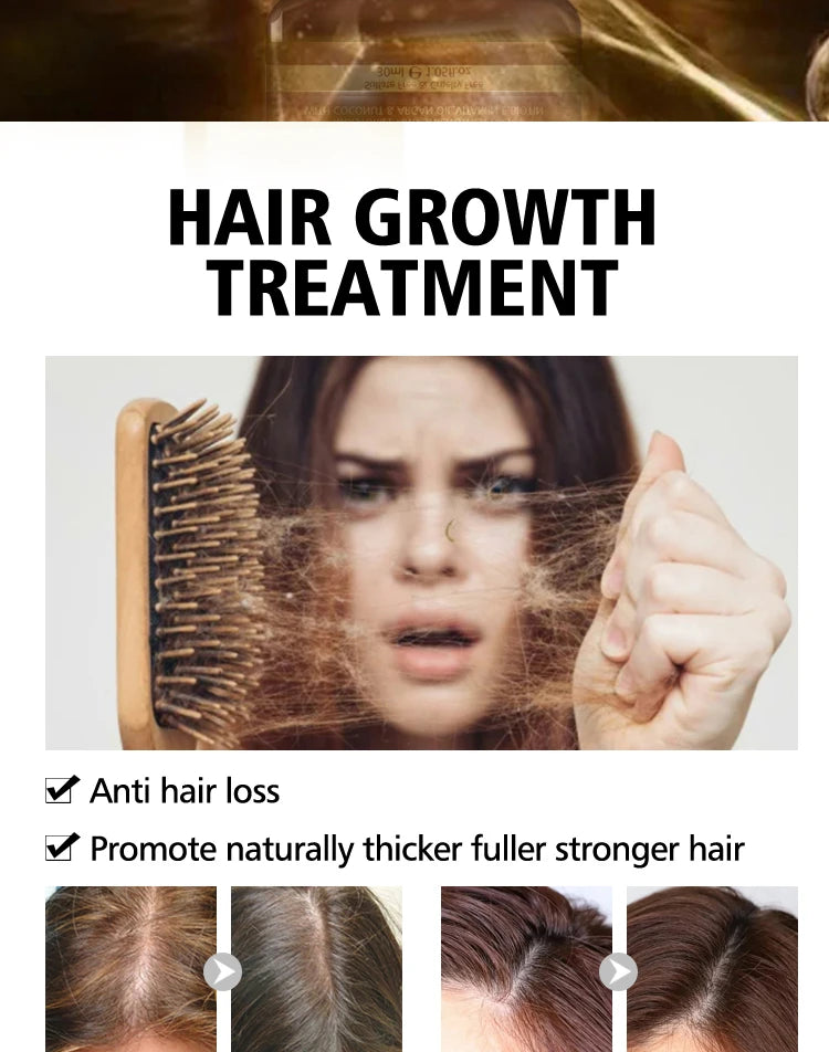 PURC Smoothing Hair Scalp Treatment Hair Shampoo Biotin Hair Oil and Conditioner Set for Men Women Hair Care