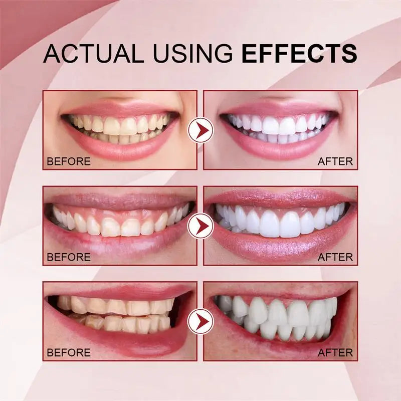 SP-8 Probiotic Toothpaste for Oral Care Whiten Clean Removes Stains Fresh Breath Formula with Lactobacillus & Sodium Saccharin