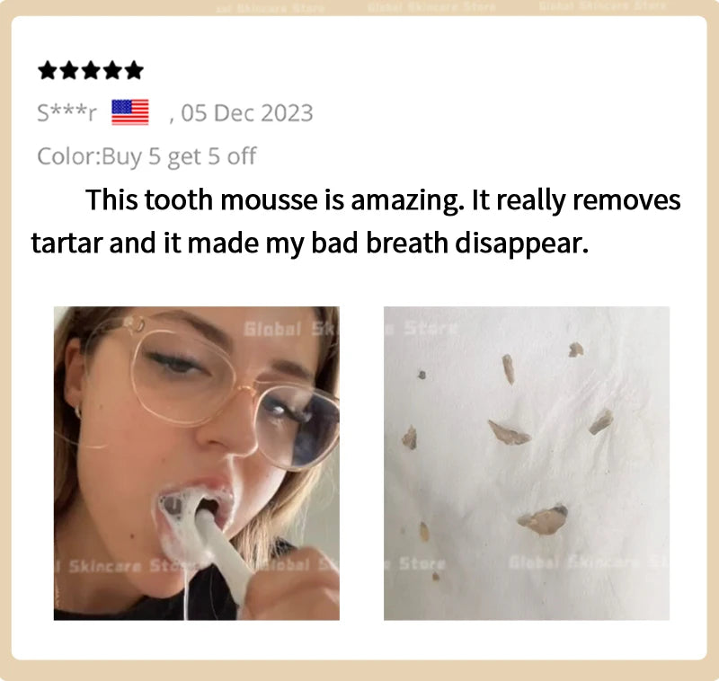 Tartar removers dissolves tartar and eliminates stains