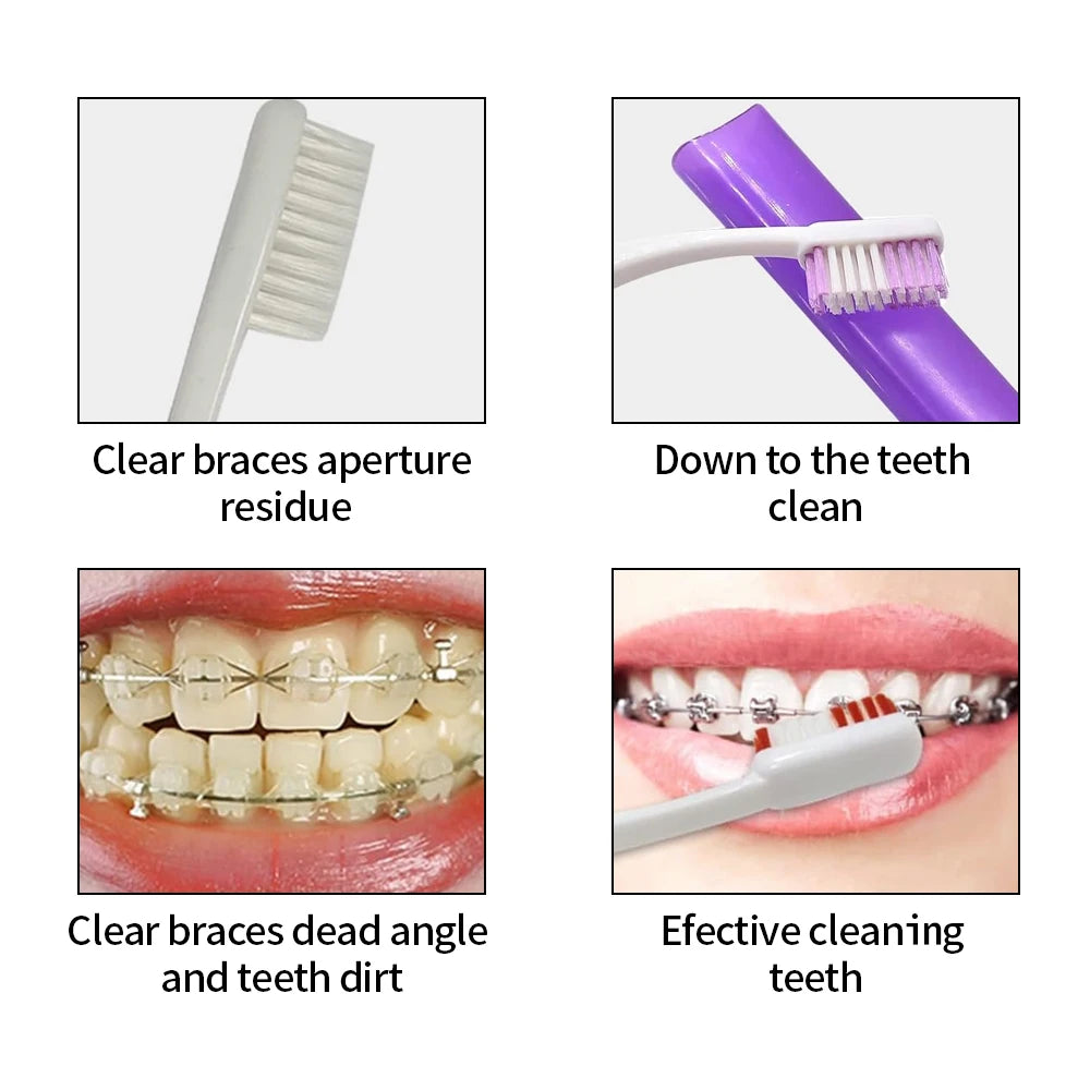8Pcs/set Orthodontic Dental Care Brush Kit Teeth Cleaning Braces Toothbrush with Interdental Brush Floss Thread Wax Travel Kit