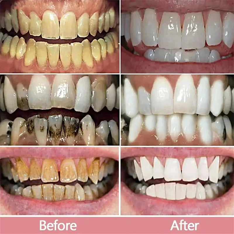 Teeth Whitening Toothpaste 5d Tooth Whitener Strips Oral Hygiene Cleaning Dental Bleaching Tools Fresh Breath Dentistry Care New