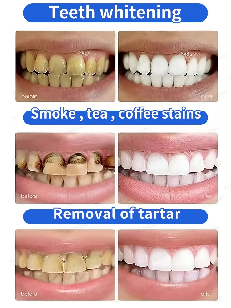 Tartar removers dissolves tartar and eliminates stains