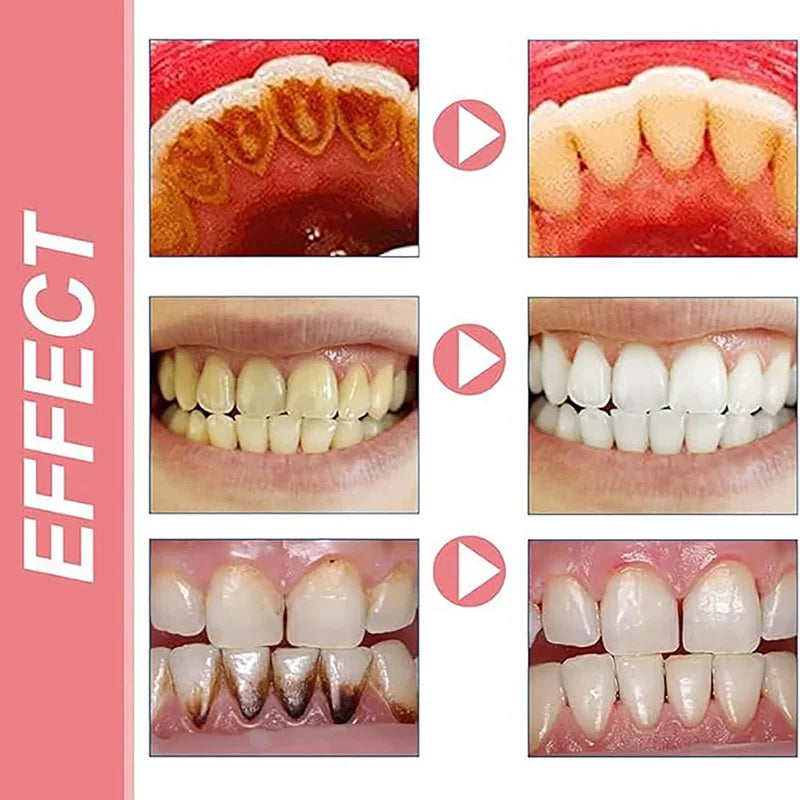 SP-8 Probiotic Toothpaste for Oral Care Whiten Clean Removes Stains Fresh Breath Formula with Lactobacillus & Sodium Saccharin