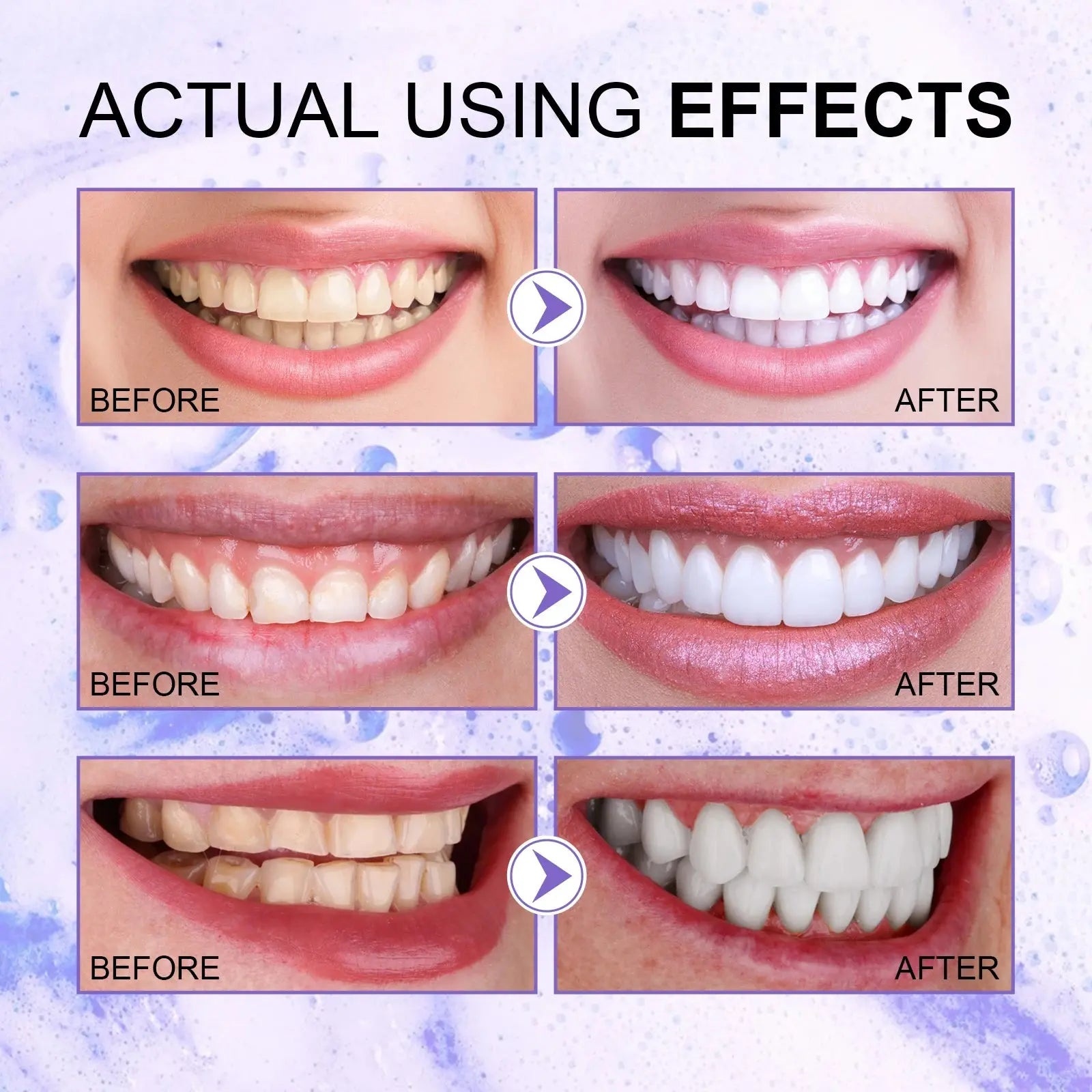 Jaysuing Gums Care Mint Teeth Whitening Mousse Yellow Cleaning Tooth Stains Desalinating Oral Odor Remove Purple Toothpaste 60ml Nova Trendz