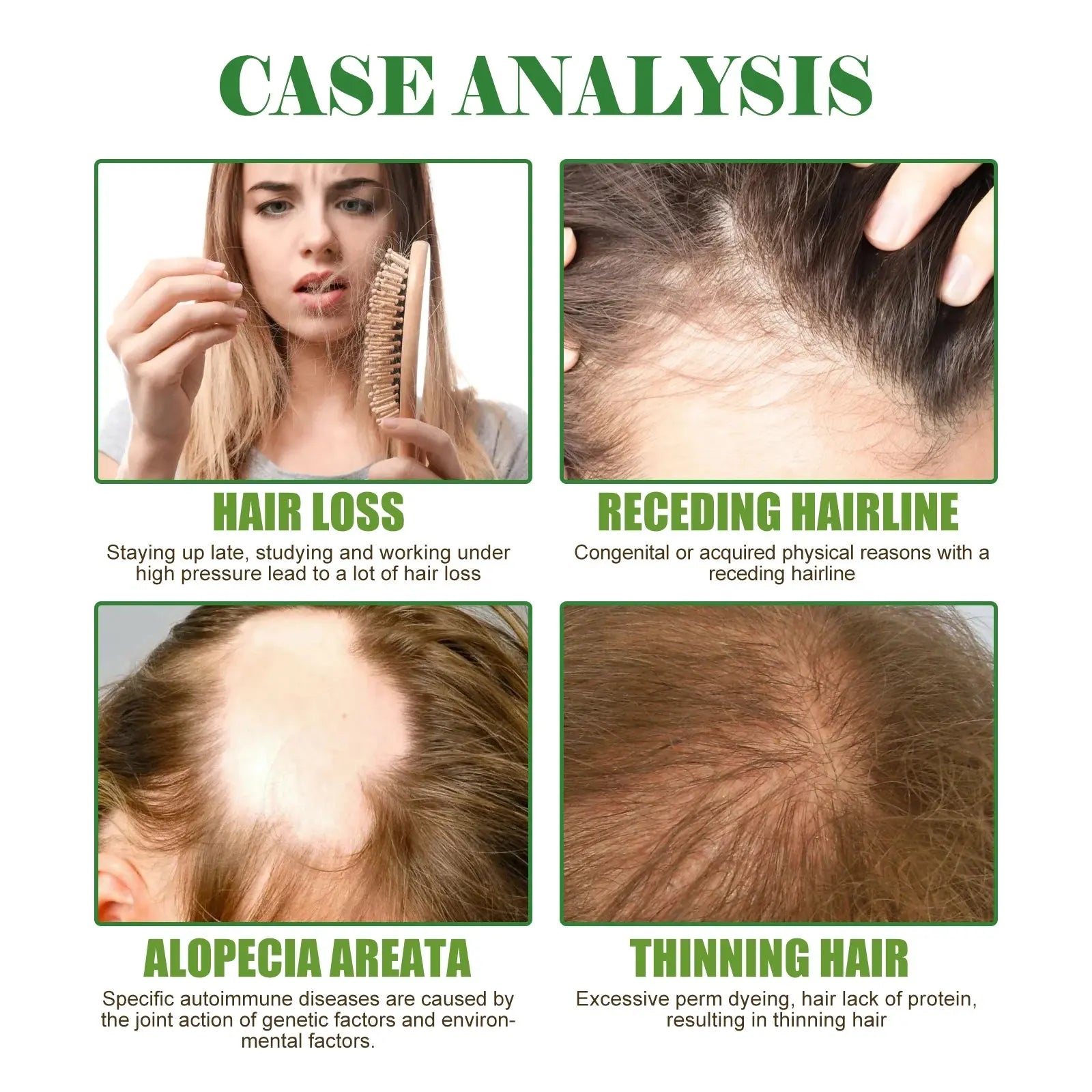 Eelhoe Rosemary Hair & Scalp Oil with Brush Rosemary Scalp Treatment Oil with Applicator Brush Nova Trendz