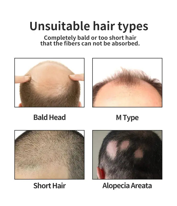 "BUNEE Hair Fiber Set 15g: Men's natural hair-dense fibers for balding areas, fills part lines, includes 15g fiber powder Nova Trendz