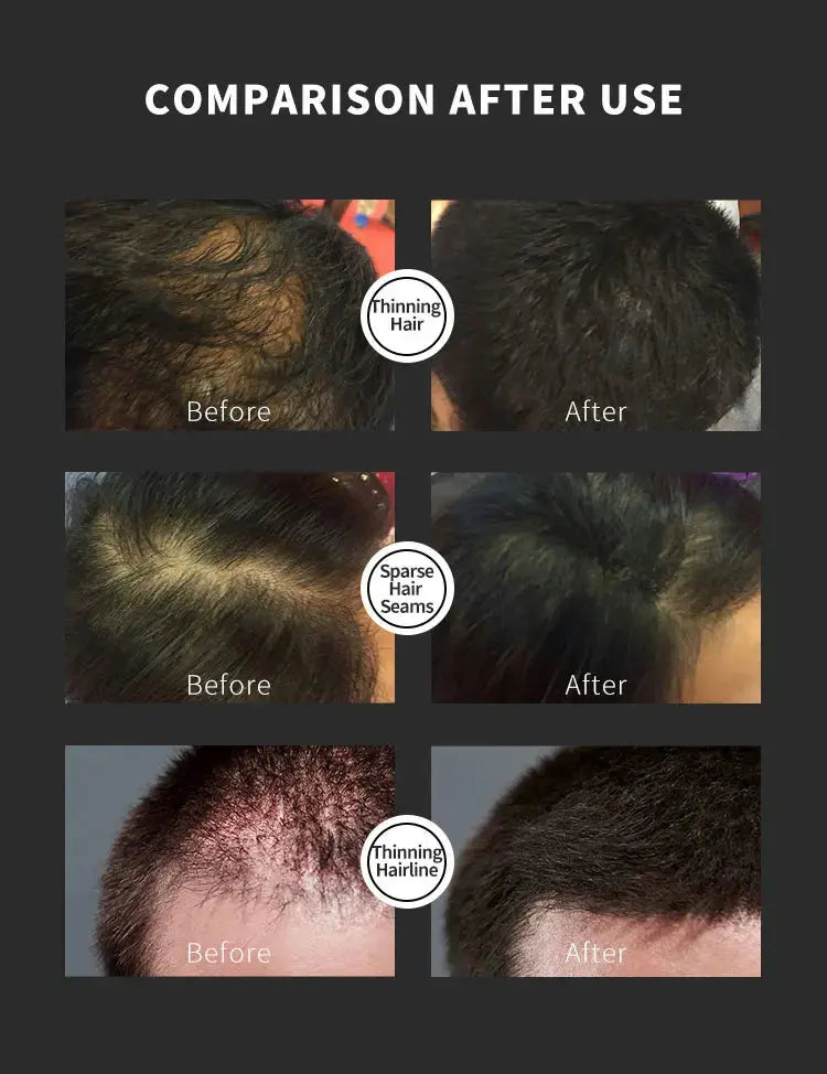 "BUNEE Hair Fiber Set 15g: Men's natural hair-dense fibers for balding areas, fills part lines, includes 15g fiber powder Nova Trendz