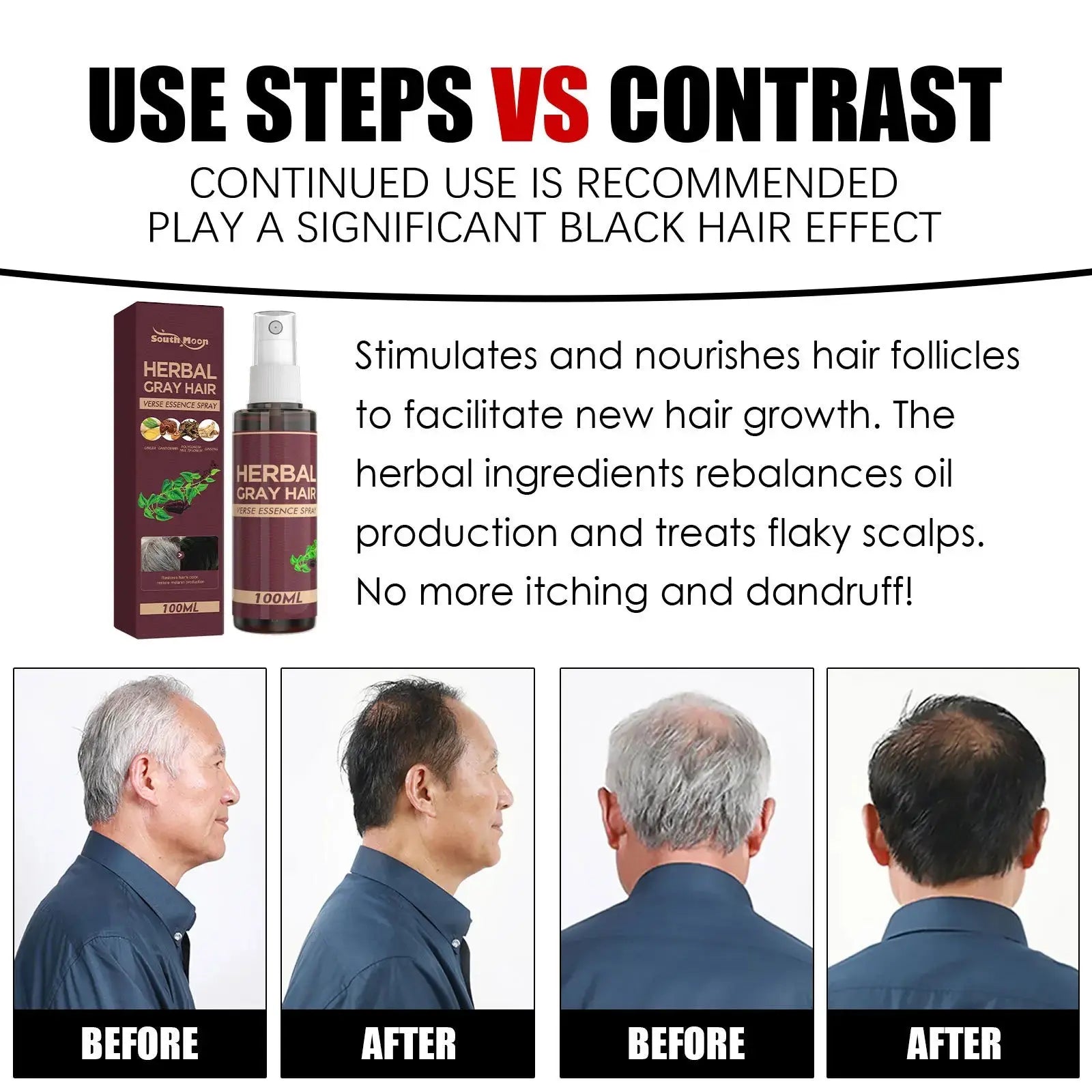 Southmoon 100ml Hair Darkening Herbal Spray White To Black Natural Color Repair Anti Grey Reduce Hair Loss Herbal Haircare Serum Nova Trendz