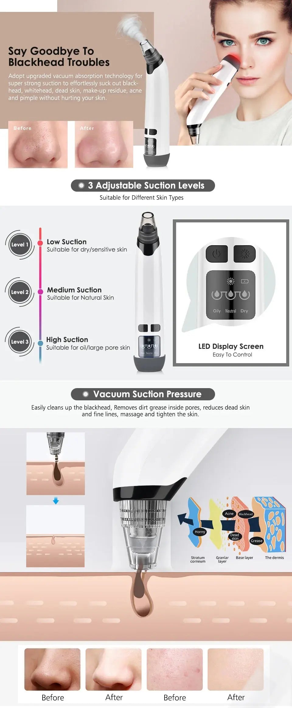 Blackhead Remover Nose T Zone Pore Vacuum Acne Pimple Removal Vacuum Suction Tool Facial Diamond Dermabrasion Machine Face Clean Nova Trendz