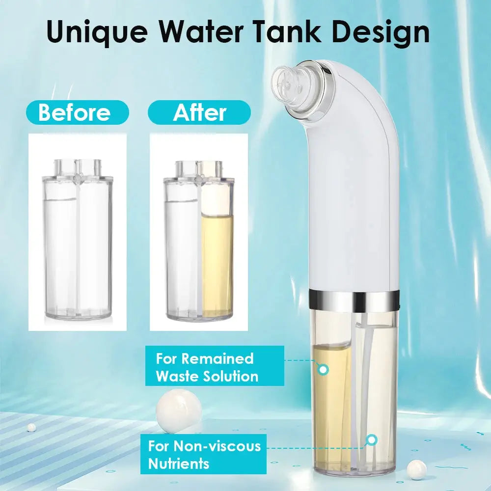 Blackhead Remover Nose T Zone Pore Vacuum Acne Pimple Removal Vacuum Suction Tool Facial Diamond Dermabrasion Machine Face Clean Nova Trendz