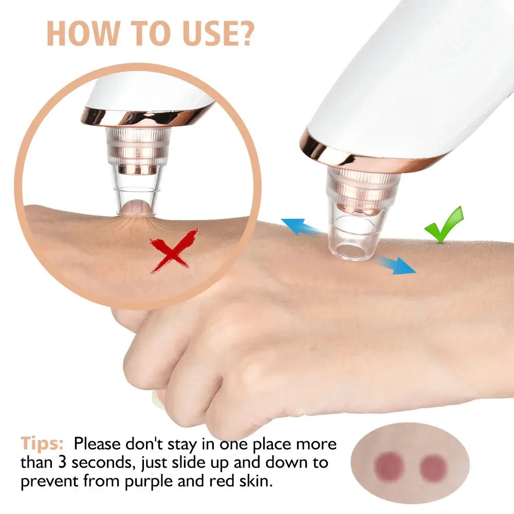 Blackhead Remover Nose T Zone Pore Vacuum Acne Pimple Removal Vacuum Suction Tool Facial Diamond Dermabrasion Machine Face Clean Nova Trendz