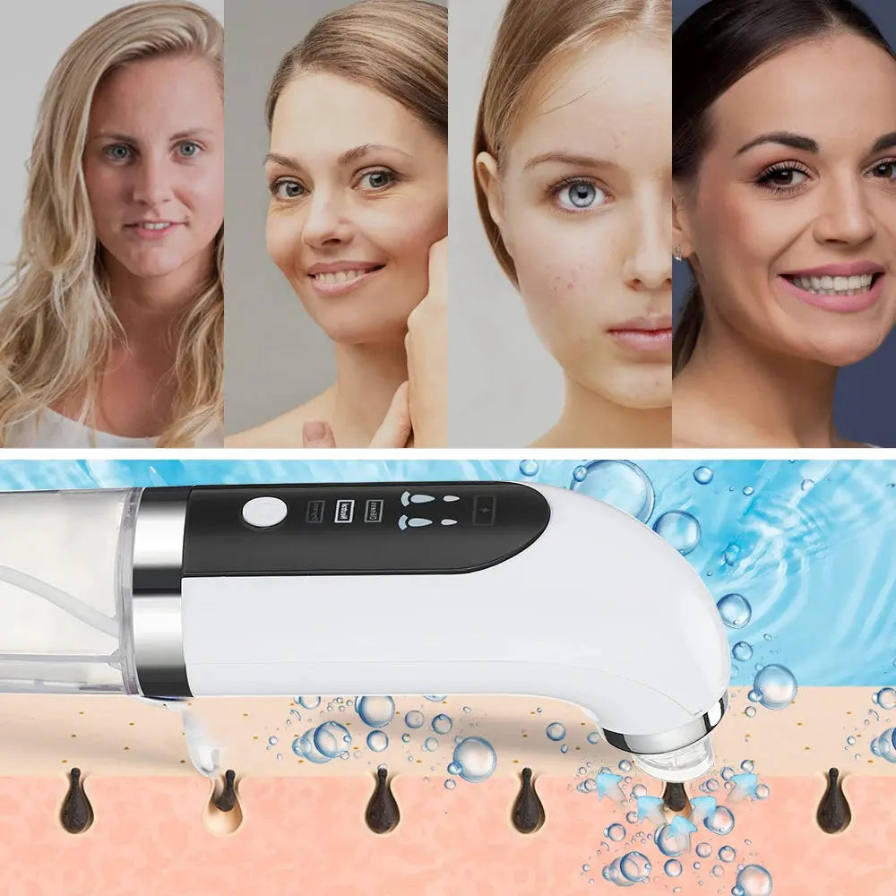 Blackhead Remover Nose T Zone Pore Vacuum Acne Pimple Removal Vacuum Suction Tool Facial Diamond Dermabrasion Machine Face Clean Nova Trendz