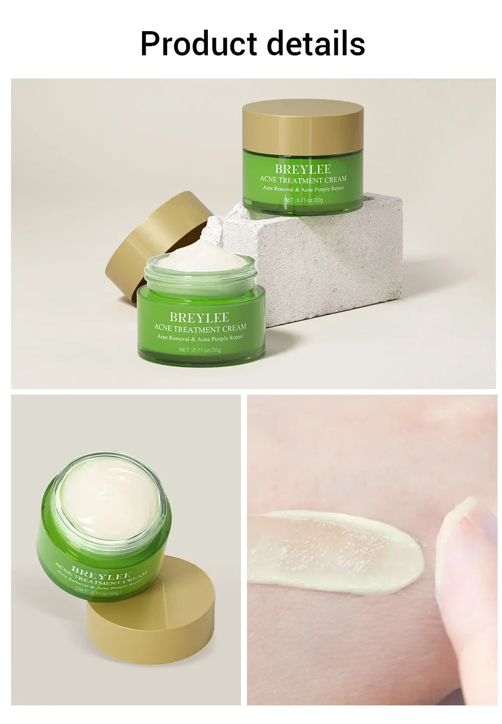 BREYLEE Acne Treatment Set 4pcs Facial Cleanser Toner Serum Cream Skin care Nova Trendz
