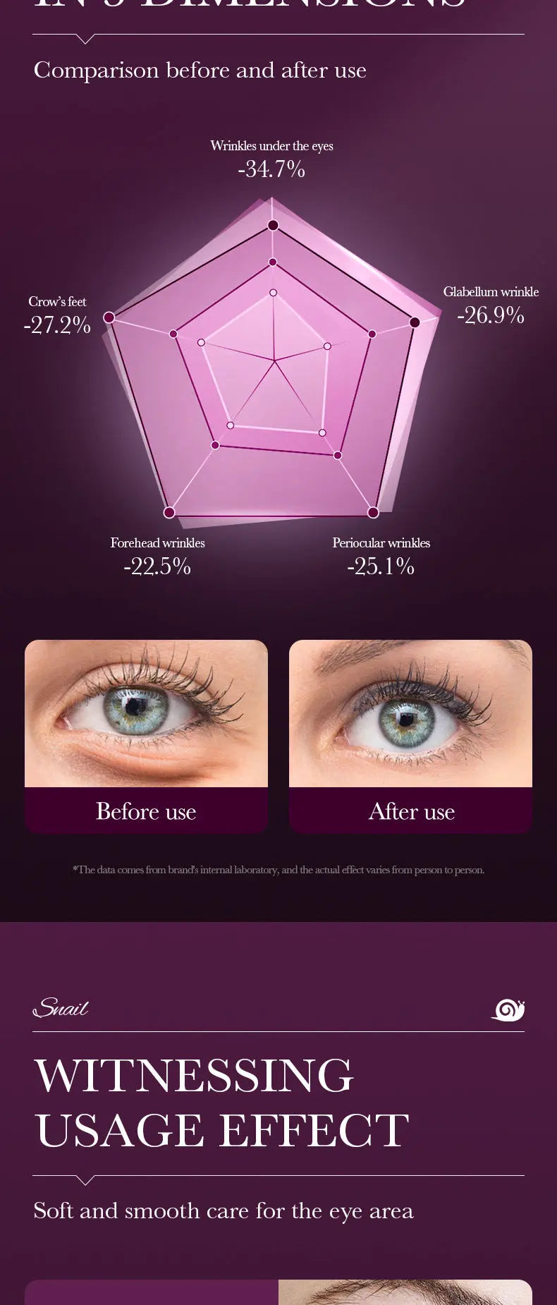 Remove Eyes Bags Eye CreamSnail Collagen Anti Dark Circles Anti-wrinkleMoisturizing Firming Beauty Eyes SkinCare Products Nova Trendz
