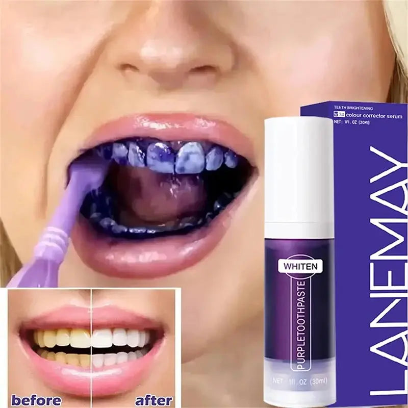 New Teeth Whitening Toothpaste 5D Teeth Whitening Stick Oral Hygiene Cleaning Teeth Whitening Tool Fresh Breath Teeth Care New - Nova Trendz