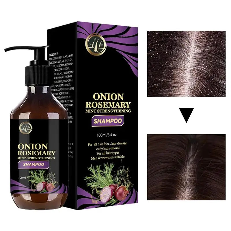 Volumizing Rosemary Onion Shampoo for Hair Care Rosemary & Onion Shampoo for Thickening and Deep Cleansing - Nova Trendz