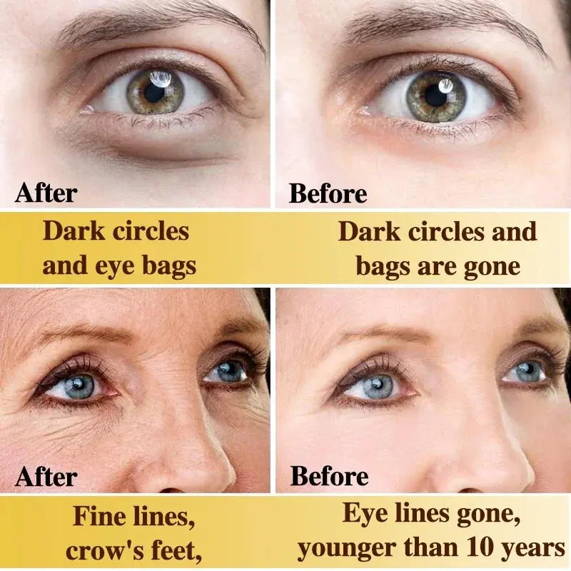 Remove Eyes Bags Eye CreamSnail Collagen Anti Dark Circles Anti-wrinkleMoisturizing Firming Beauty Eyes SkinCare Products Nova Trendz