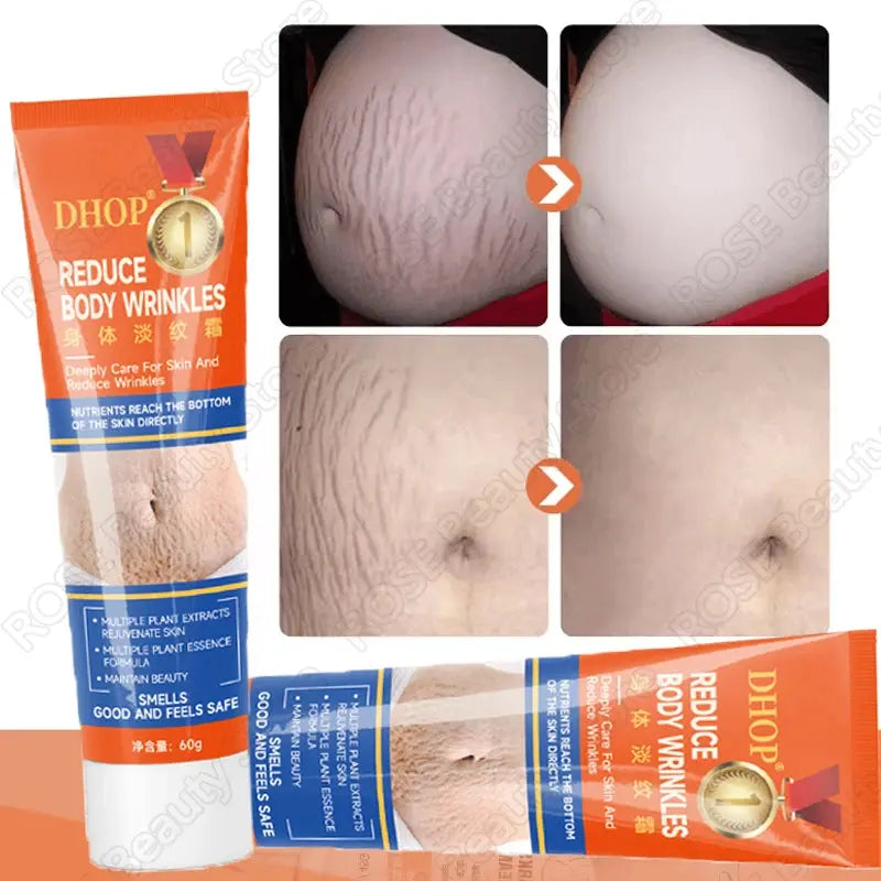 Stretch Marks Permanent Removal Cream Maternity Pregnant Women Pregnancy Anti-Winkle Smooth Repair Firming Skin Body Skin Care Nova Trendz