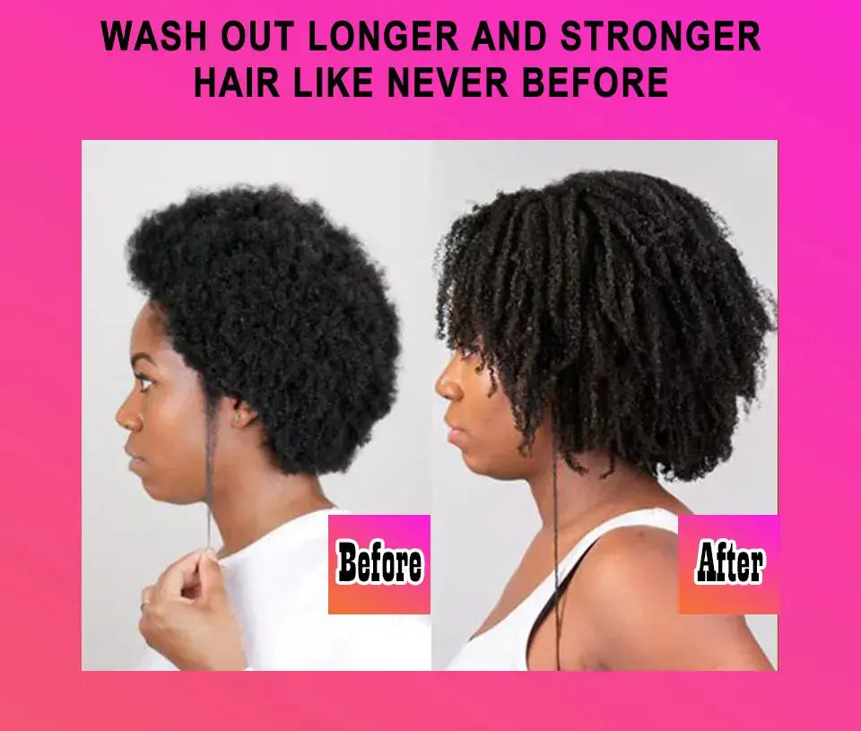 CHEBE Hair Growth Shampoo Conditioner Set Anti Hair Loss Treatment for Men Women Fast Thicken Regrowth Oil Beauty Health SEVICH Nova Trendz