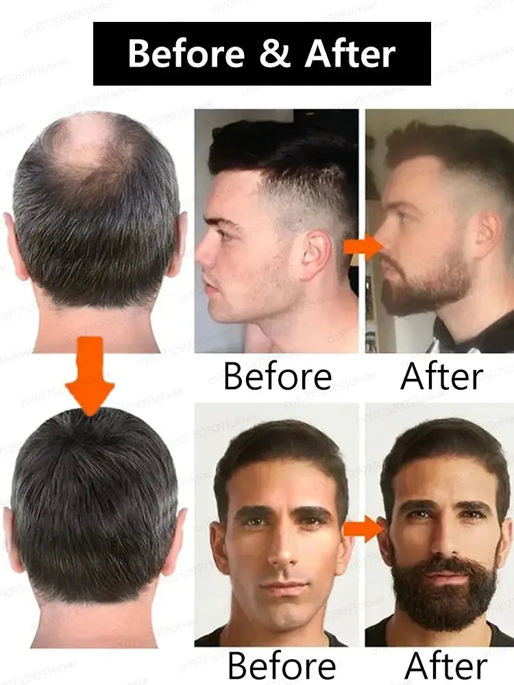 The most effective beard growth essence in 2025, grow a thick beard in 7 days. Chest hair, leg hair, beard and hair growth Nova Trendz