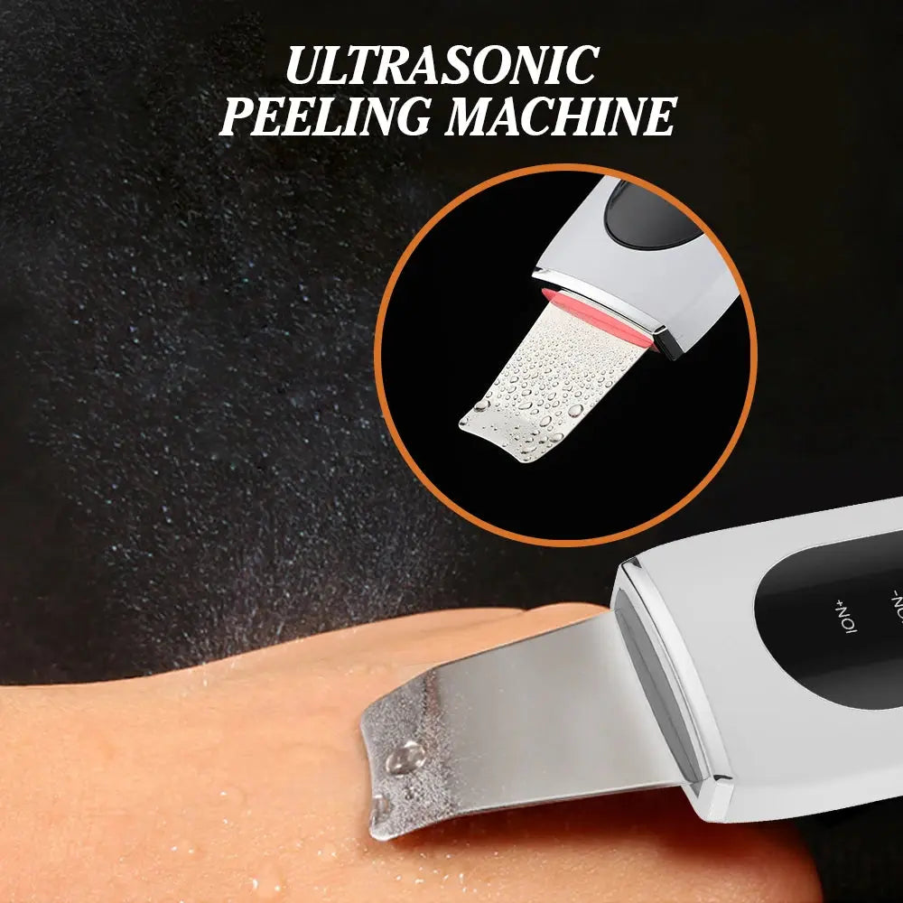 Skin Scrubber Ultrasonic Facial Machine for Home Use Spatula for Blackhead Remover Shovel Peeling Pore Cleaner Face Lift Massage - Nova Trendz