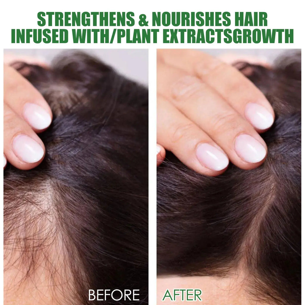 Rosemary Hair Care Set Contains Rosemary Hair Roller Hair Spray Essential Oil Nourish Hair Soft Fluffy Strong Moisturizing Root Nova Trendz