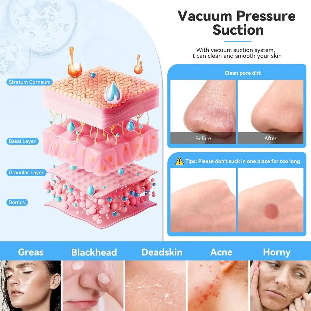 Handheld Diamond Microdermabrasion Machine Newest Facial Peeling Beauty Device Blackhead Removal Acne Clearning Skin Care Tool Nova Trendz