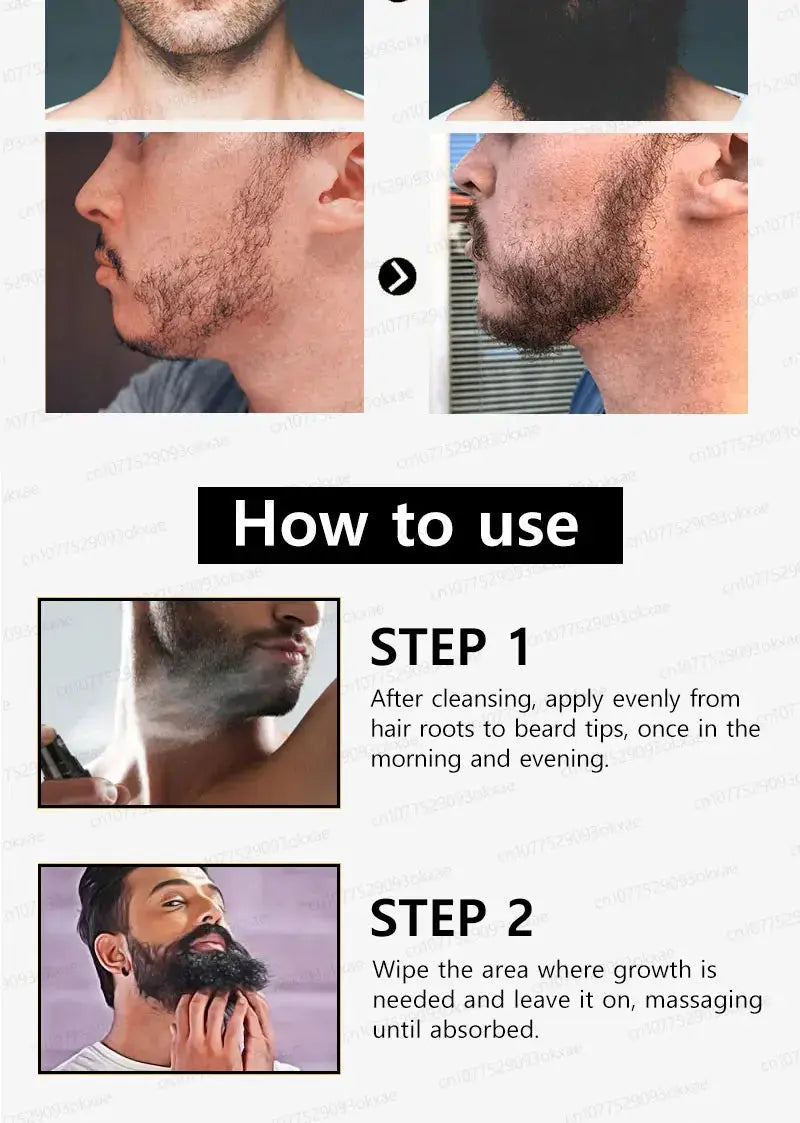 The most effective beard growth essence in 2025, grow a thick beard in 7 days. Chest hair, leg hair, beard and hair growth Nova Trendz