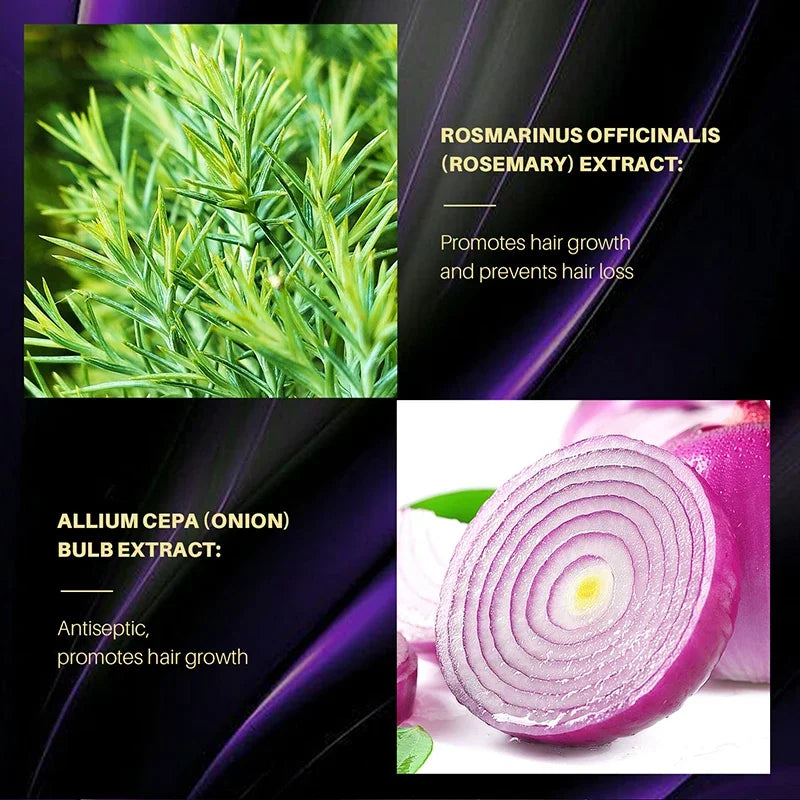 Volumizing Rosemary Onion Shampoo for Hair Care Rosemary & Onion Shampoo for Thickening and Deep Cleansing - Nova Trendz