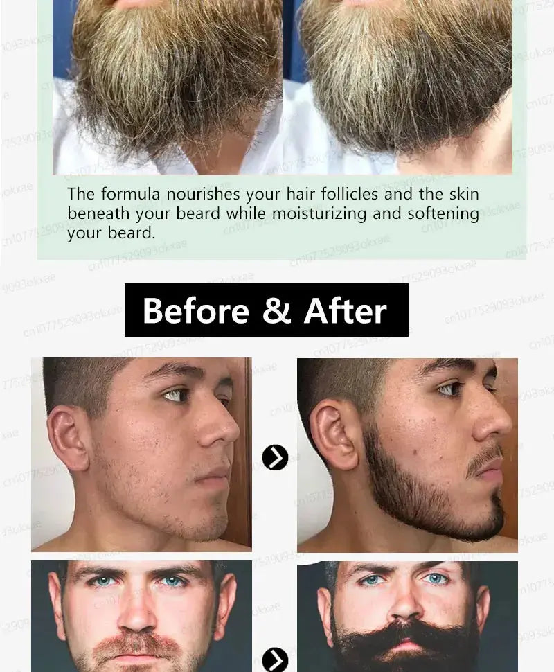 The most effective beard growth essence in 2025, grow a thick beard in 7 days. Chest hair, leg hair, beard and hair growth Nova Trendz
