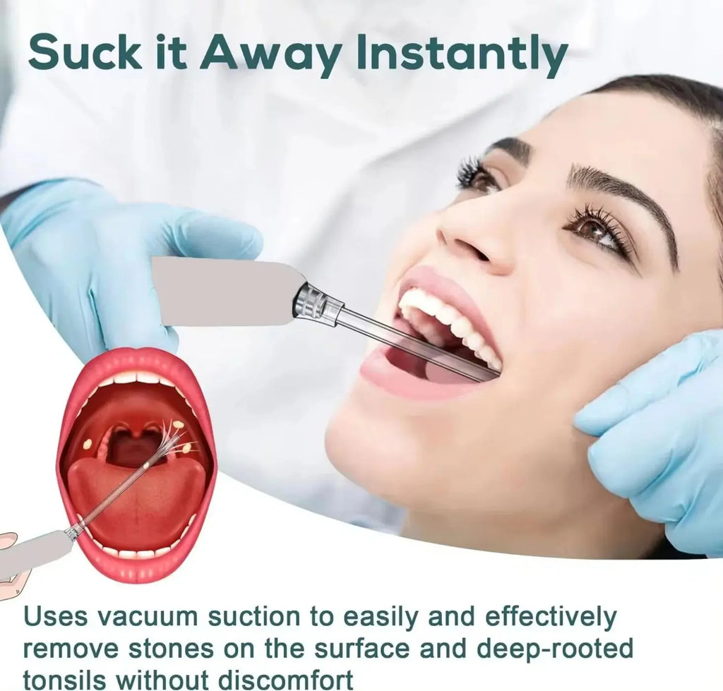 Electronic Vacuum Tonsil Stone Remover Kit with 5 Suction Modes 10in1 Tonsil Stone Cleaner Mouth Cleaning Tool Oral Fresh Care Nova Trendz