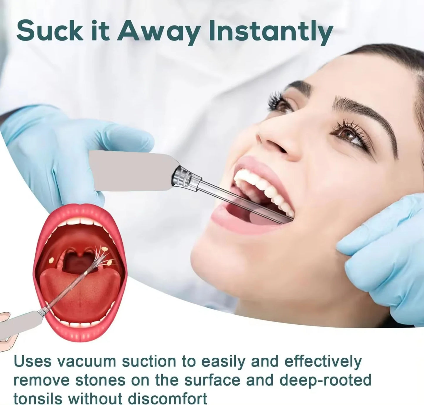 Electronic Vacuum Tonsil Stone Remover Kit with 5 Suction Modes 10in1 Tonsil Stone Cleaner Mouth Cleaning Tool Oral Fresh Care