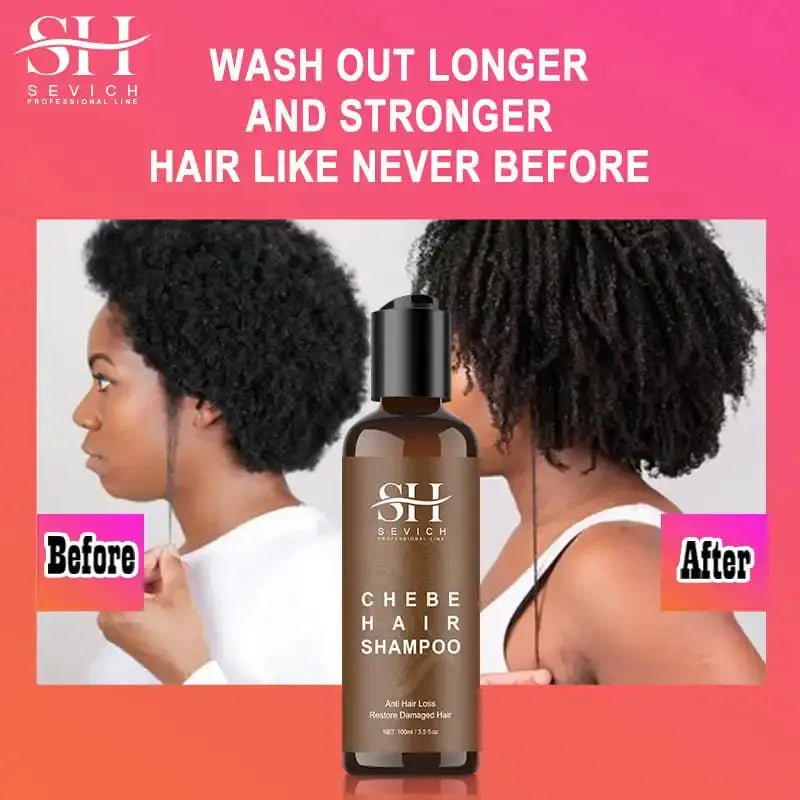 CHEBE Hair Growth Shampoo Conditioner Set Anti Hair Loss Treatment for Men Women Fast Thicken Regrowth Oil Beauty Health SEVICH Nova Trendz