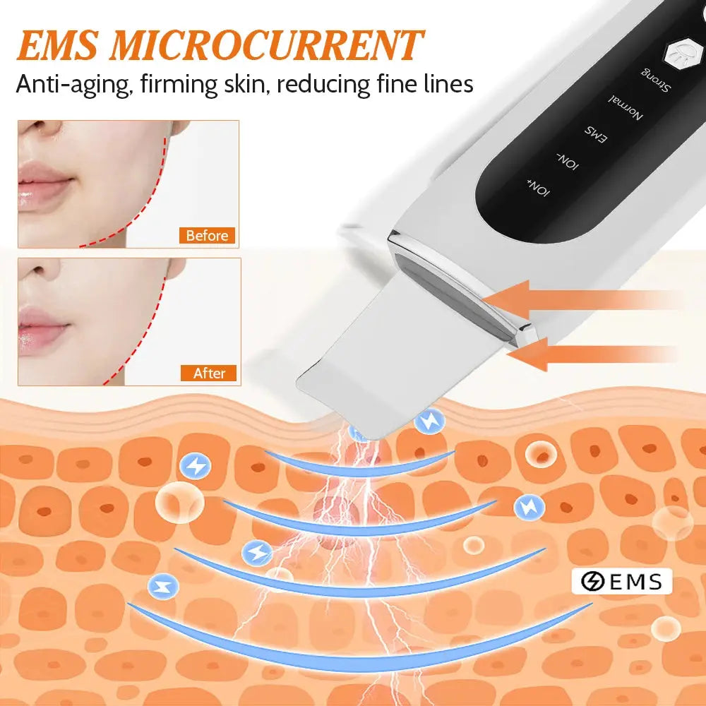 Skin Scrubber Ultrasonic Facial Machine for Home Use Spatula for Blackhead Remover Shovel Peeling Pore Cleaner Face Lift Massage - Nova Trendz