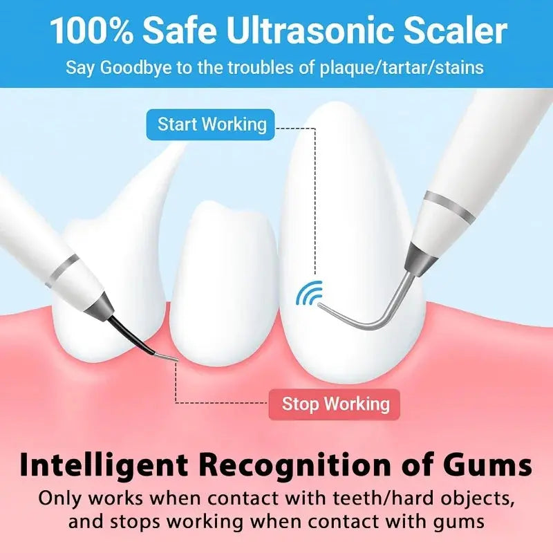 Dog Cat Grooming Smart Dental Ultrasonic Scaler Household Tooth Stone Remover Tooth CleanerTooth Whitening Oral Cleaning Tools - Nova Trendz