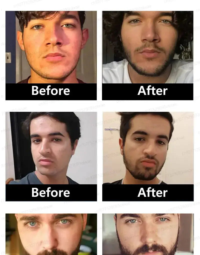 The most effective beard growth essence in 2025, grow a thick beard in 7 days. Chest hair, leg hair, beard and hair growth Nova Trendz