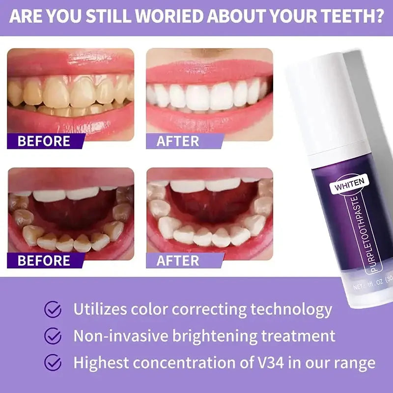 New Teeth Whitening Toothpaste 5D Teeth Whitening Stick Oral Hygiene Cleaning Teeth Whitening Tool Fresh Breath Teeth Care New - Nova Trendz