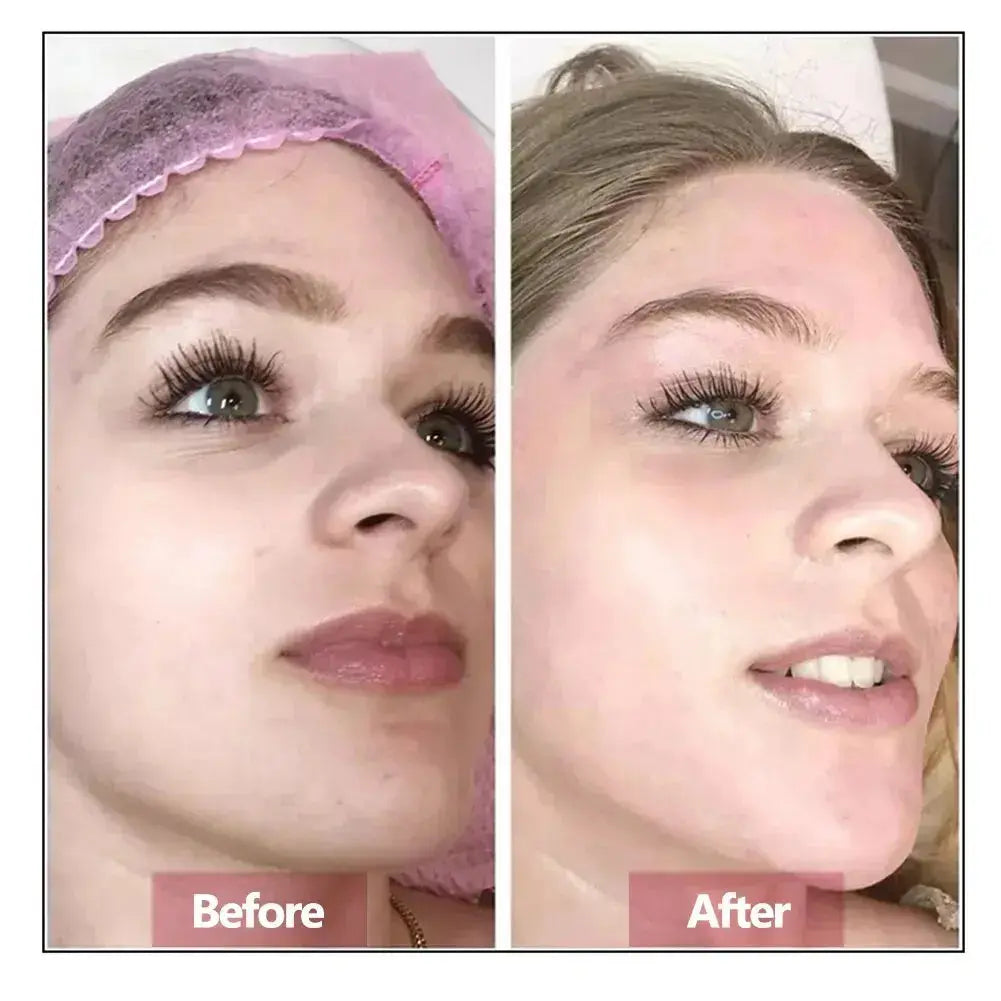 Hyaluronic Acid Face Serum Essence Skin Repair Rejuvenation Firming Moisturizing Hydrating Anti Aging Nova Trendz