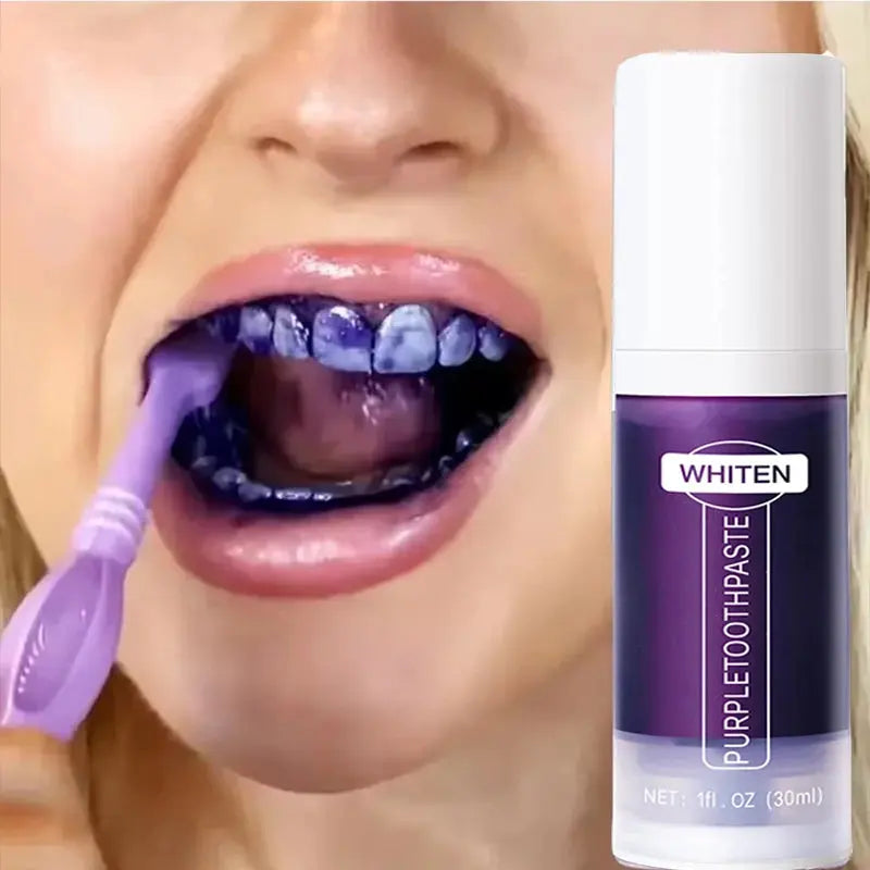 New Teeth Whitening Toothpaste 5D Teeth Whitening Stick Oral Hygiene Cleaning Teeth Whitening Tool Fresh Breath Teeth Care New - Nova Trendz