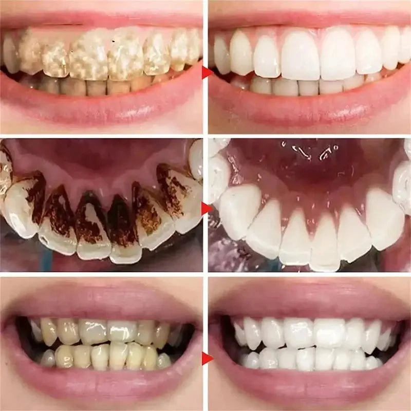 Teeth Whitening Toothpaste 5d Tooth Whitener Strips Oral Hygiene Cleaning Dental Bleaching Tools Fresh Breath Dentistry Care New - Nova Trendz