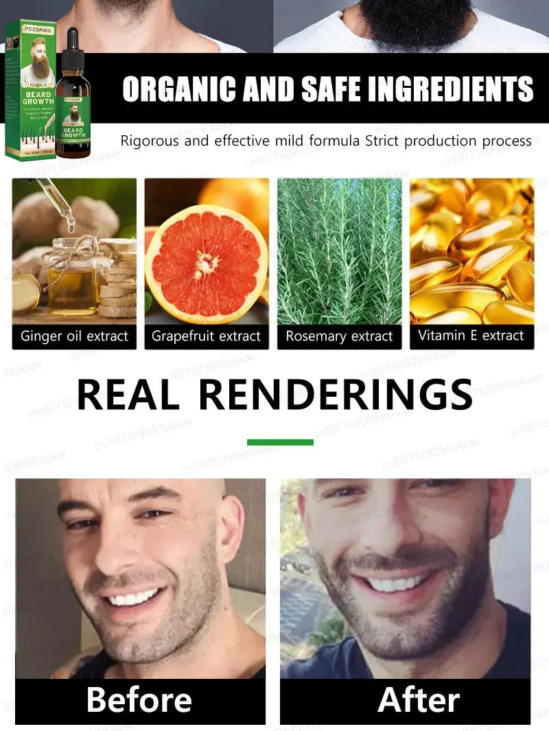 The most effective beard growth essence in 2025, grow a thick beard in 7 days. Chest hair, leg hair, beard and hair growth Nova Trendz