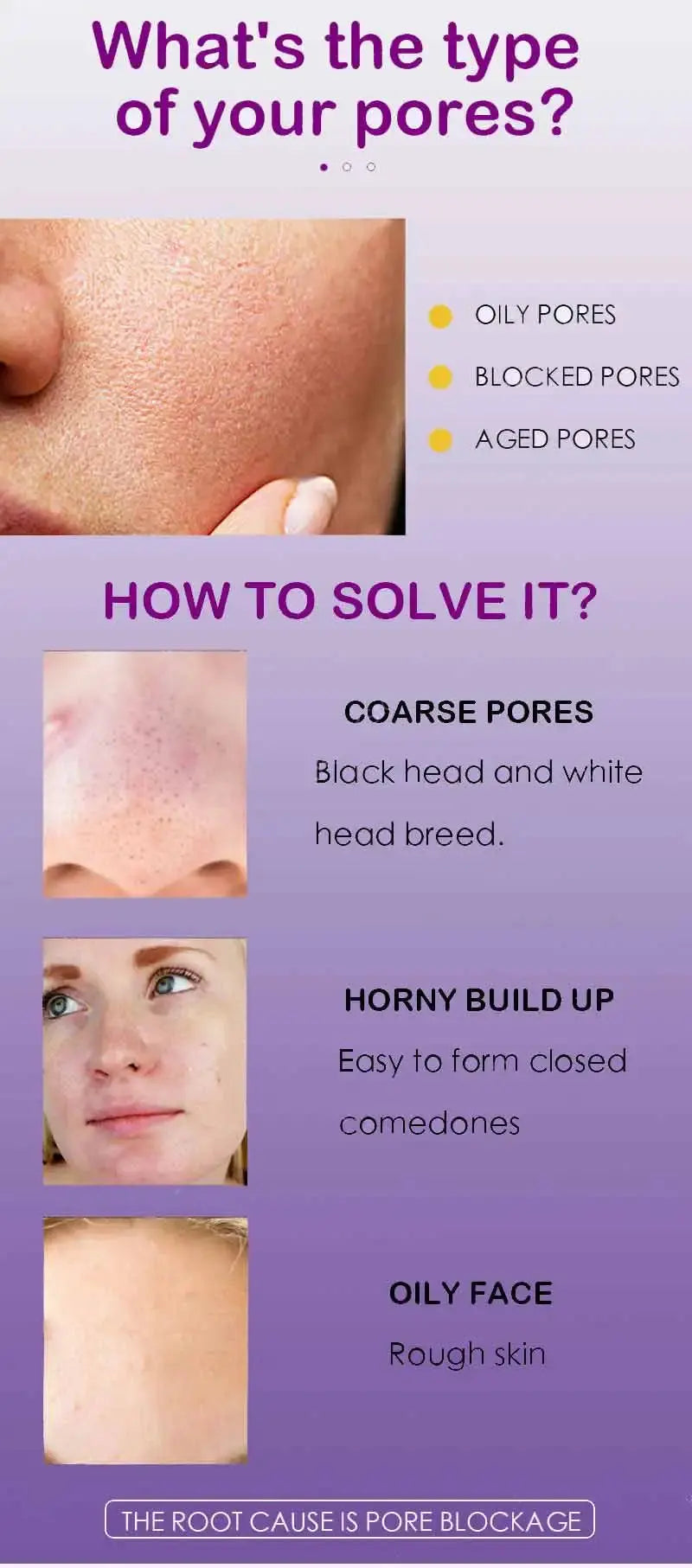 Pore Shrinking Serum Face Removing Large Pores Tightening Repairing Facial Pore Minimizing Essence Skin Care Beauty Firm skin Nova Trendz