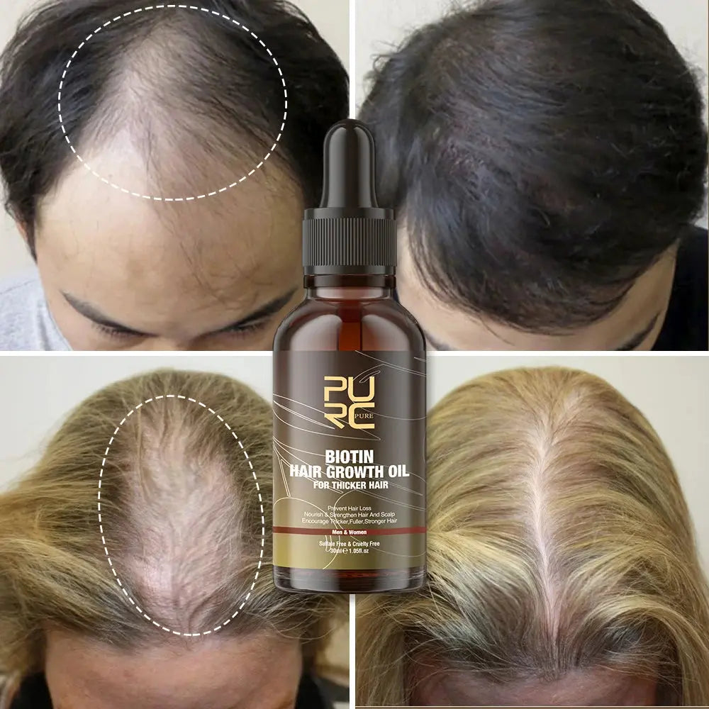 PURC Biotin Hair Care Set for Smooth, Healthy-Looking Hair PURC Biotin Shampoo and Conditioner Set with Hair Oil Nova Trendz