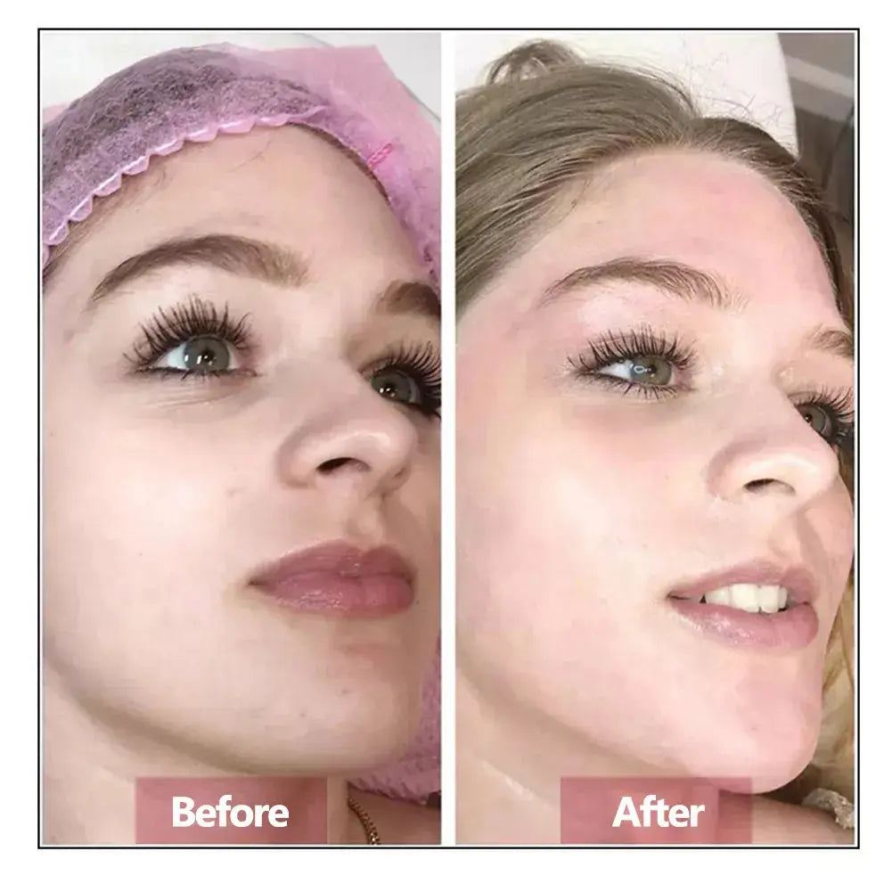 Hyaluronic Acid Face Serum Essence Skin Repair Rejuvenation Firming Moisturizing Hydrating Anti Aging Nova Trendz