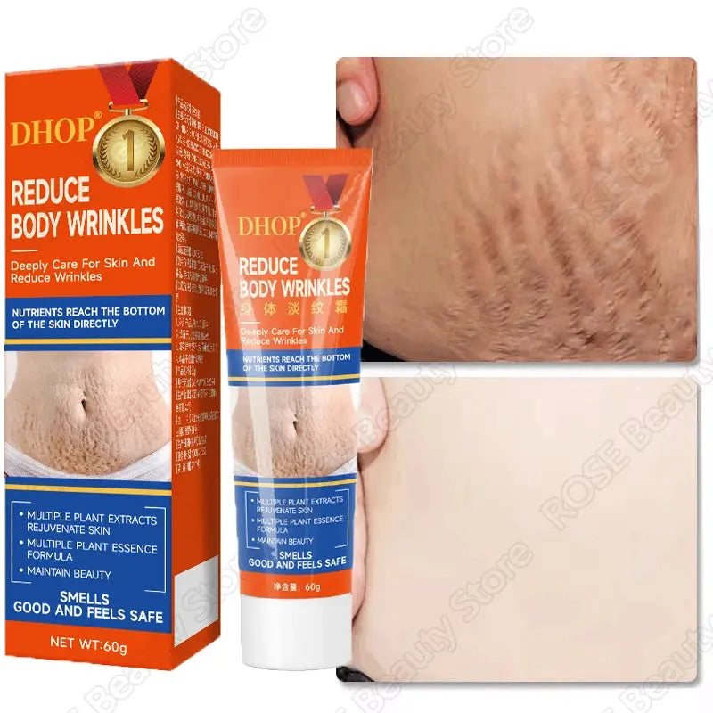 Stretch Marks Permanent Removal Cream Maternity Pregnant Women Pregnancy Anti-Winkle Smooth Repair Firming Skin Body Skin Care Nova Trendz