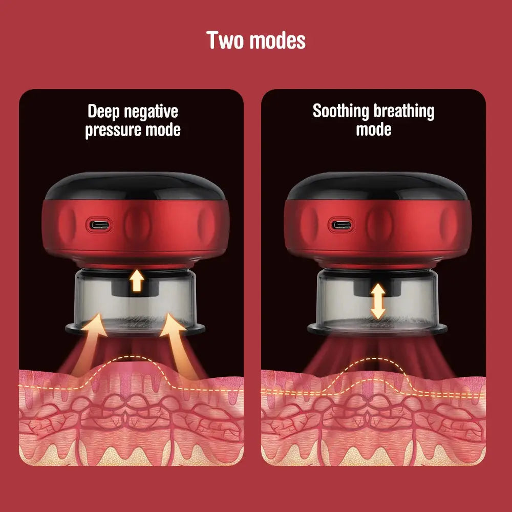 Body Scraping Massage Smart Electric Vacuum Cupping Heating Suction Cup Device Back Neck Arm Massger 6/12 Level Cupping Nova Trendz